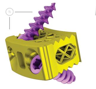 Кейдж міжхребцевий шийний опуклий титановий блокований з гвинтами